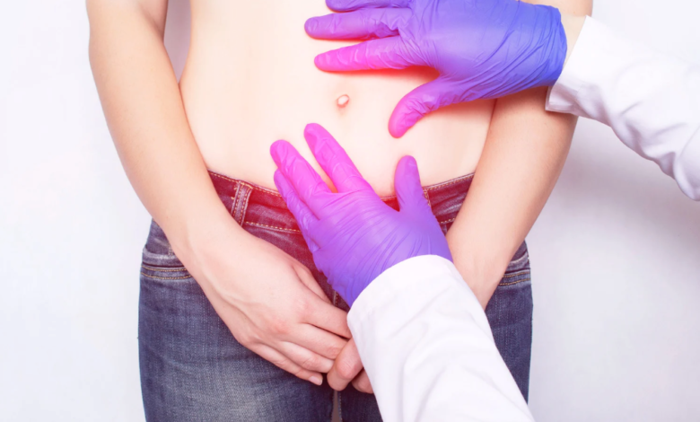 What to Expect Before, During, and After Hernia Surgery