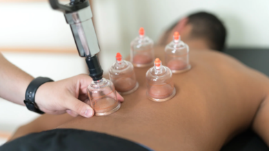 How Cupping Therapy Enhances Blood Flow and Promotes Healing