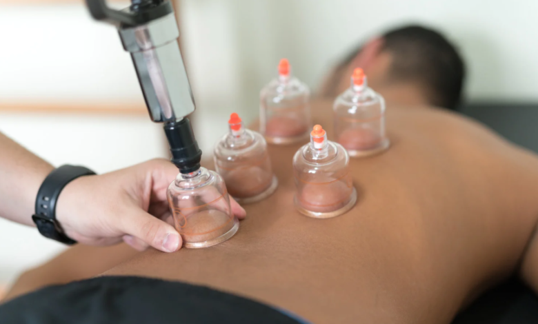 How Cupping Therapy Enhances Blood Flow and Promotes Healing