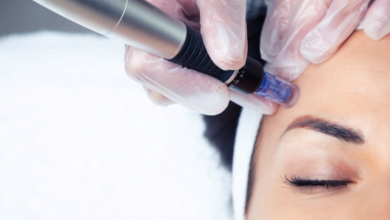 How Often Should You Get A Microneedling Treatment