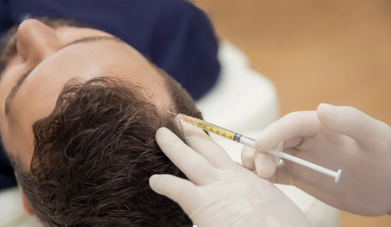 TruDOSE PRP Injections for Hair Restoration: A Regenerative Solution for Thinning Hair