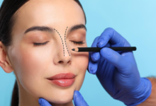 What Makes Dubai the Go-To Destination for Rhinoplasty Procedures?
